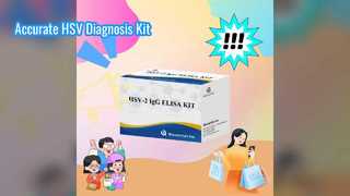 HSV-IgG ELISA 테스트 키트 정확한 진단
