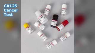 암 모니터링을 위한 CA125 ELISA 테스트