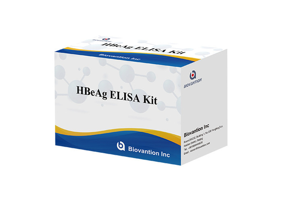 인간 HBe 항원 Elisa 시험 키트 혈액 B 형 간염 봉투 항원 시험