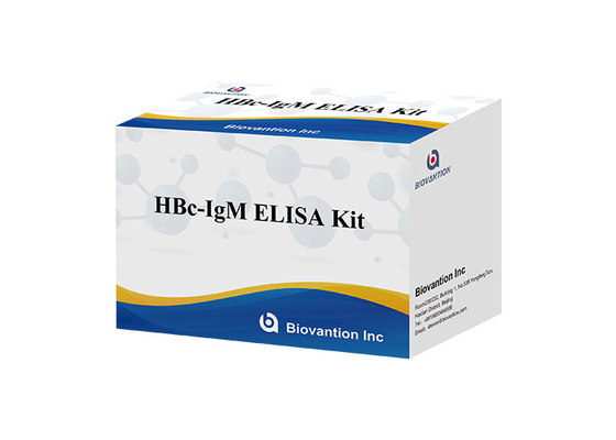ISO13485 하브크 이그텀 시험 키트 B 형 간염 핵심 항체 이그텀 테스트