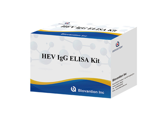 간염 Ｅ 바이러스에 대한 igg 항체를 위해 증상을 나타낸 헤브 인간 igg elisa 장비