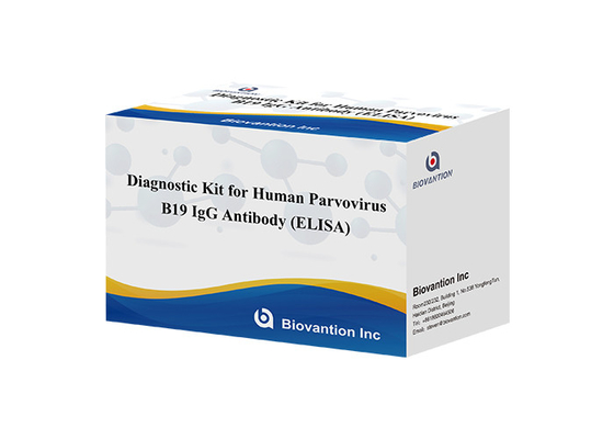 인간 패르보바이러스 B19 IgG ELISA 검사 키트의 진단 키트