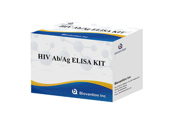 60분 ISO13485 HIV Ab Ag 시험 Hiv 4번째 발생 분석 elisa 장비