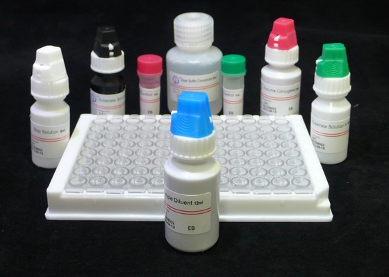 60분 ISO13485 HIV Ab Ag 시험 Hiv 4번째 발생 분석 elisa 장비