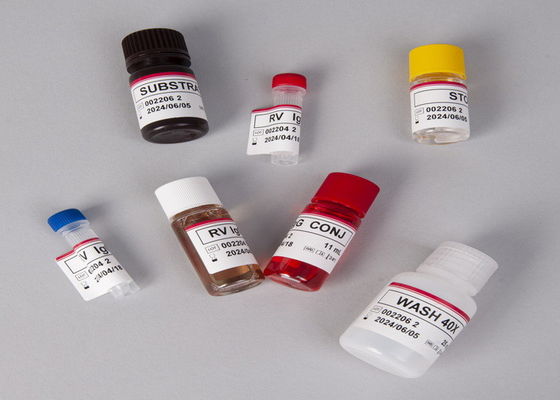 알파 태아 단백 AFP ELISA 검사 키트