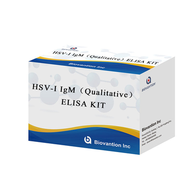 실험실 또는 병원 HSV I IgG ELISA 테스트 키트 사용 지침