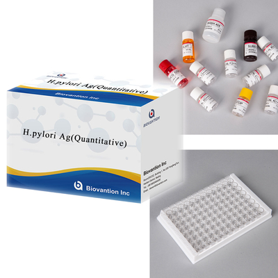 헬리코박터 파일로리 항원 H.pylori Ag ((량적) ELISA 검사