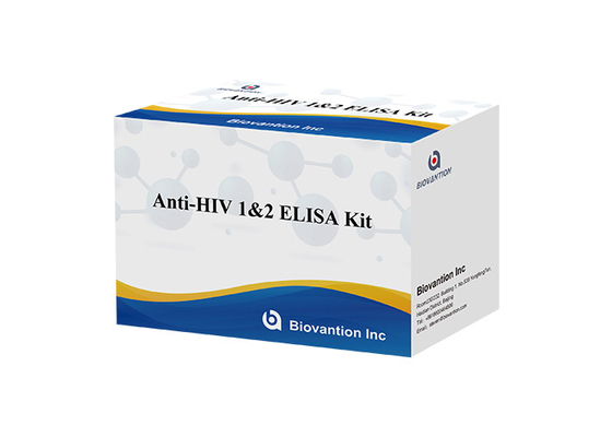 HIV 엘리사 테스트 키트 18개월 유효기간 높은 민감성과 특수성을 가진 엘리사 테스트