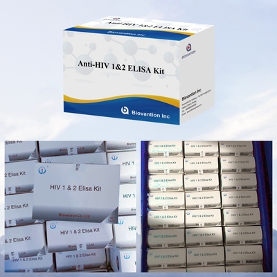 비오반션 항 HIV ELISA 테스트 키트 18 개월 HIV-1 및 HIV-2 테스트의 유효기간