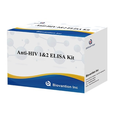 HIV 엘리사 테스트 키트 18개월 유효기간 높은 민감성과 특수성을 가진 엘리사 테스트