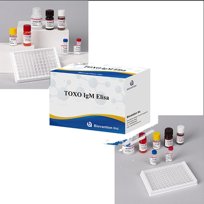 병원, 연구소, 클리닉에서 고정도 토크소 IgM ELISA 테스트 키트를 사용합니다.