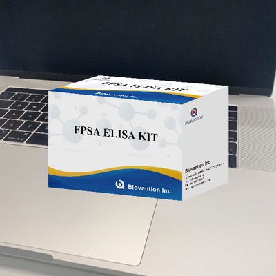 ELISA 면역 검사 검출 키트 FPSA 무료 전립선 특성 항원 엘리사 테스트 키트