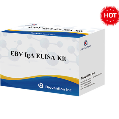 EBV-VCA IgA Ab ELISA 치아 키트 면역 분석 검출 키트 목적 사용