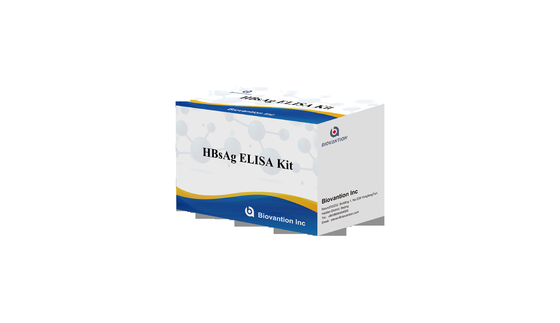 ELISA 검출 반응기 키트 높은 정확성 HBsAg Elisa 테스트 키트