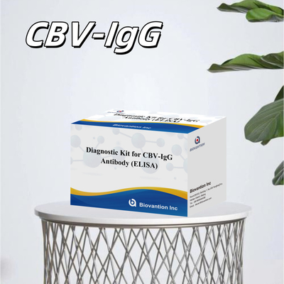 인간 CBV-IgG 항체를 감지하기 위한 감수성 진단 키트 정확한 샘플 유형 검출을 위한 Elisa 키트