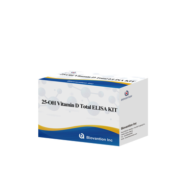 글루타민산 디카보시라제 항체 GAD-Ab ELISA 테스트 키트