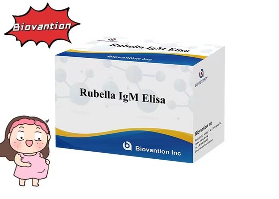 루벨라 IgM ELisa 테스트 키트 유성 10 임신부 사용