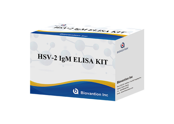 HSV 2 IgM 토치 ELISA 테스트 키트 사용 지침