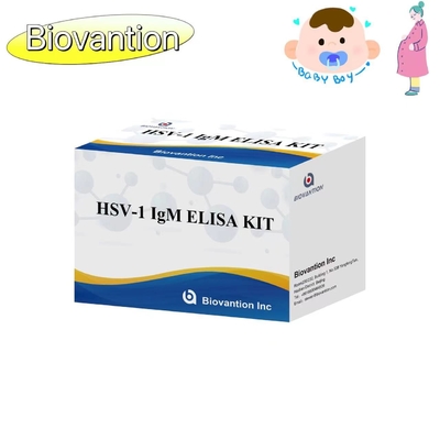 타치 ELISA 테스트 키트 HSV 1 IgM 높은 뜨거운 판매 진단 반응기 IVD