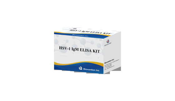 타치 ELISA 테스트 키트 HSV 1 IgM 높은 뜨거운 판매 진단 반응기 IVD