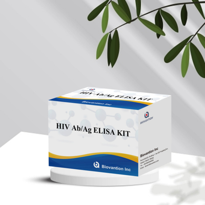 HIV Ab Ag Elisa 테스트 키트 18개월의 유효기간과 높은 민감성/특수성