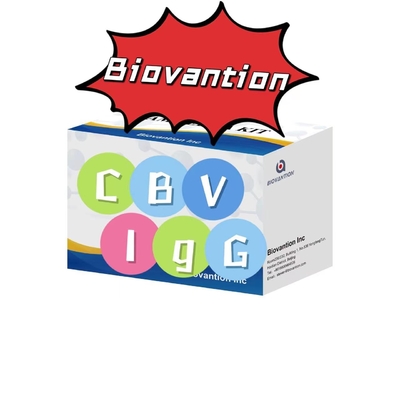 CBV-IgG 항체 ELISA 검사 키트