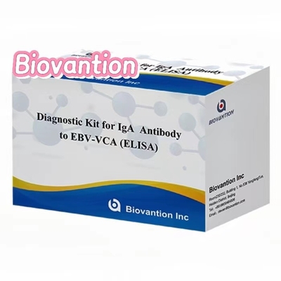 50μl 혈청 표본을 이용한 의료 진단용 고 민감성 EBV VCA IgA ELISA 키트