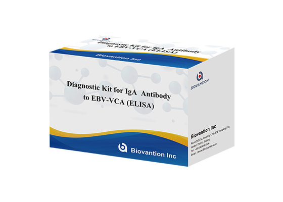 50μl 혈청 표본을 이용한 의료 진단용 고 민감성 EBV VCA IgA ELISA 키트