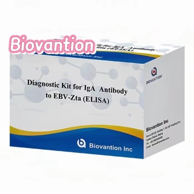 EBV-Zta 에 대한 IgA 항체 진단 키트 ELISA 테스트 키트 면역 흡수 검사 키트