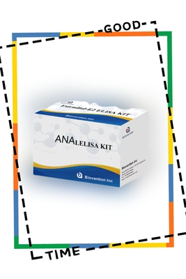 항 ANA IgG ELISA 테스트 키트 항 핵 IgG 항체 질적 검출