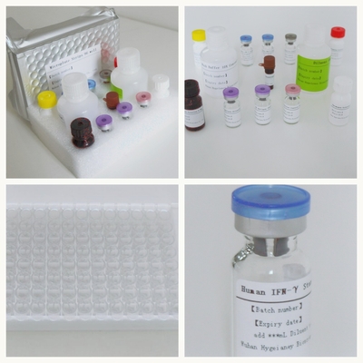 정확성 및 민감성 ELISA 테스트 키트 신속하고 쉬운 검출 TB IGRA ELISA 진단