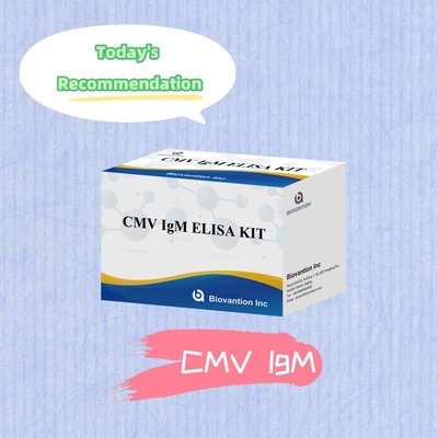 마크로파지 IgM 질적 ELISA 테스트 IVD 실험용 키트 고민성