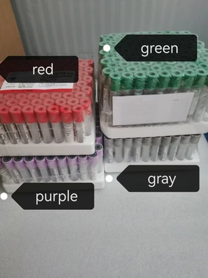 장수기간과 2C-8C 보존 방법의 TB-IGRA ELISA 테스트 키트