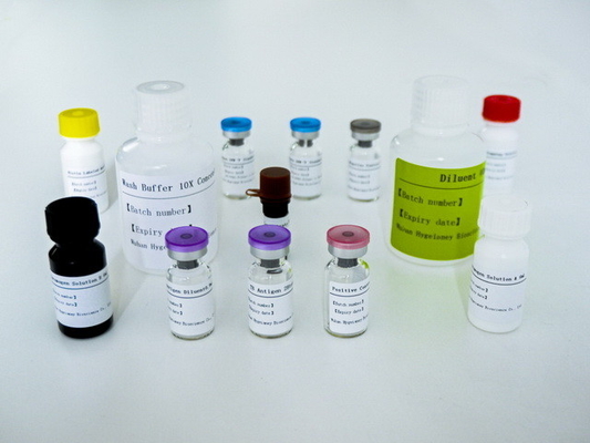 장수기간과 2C-8C 보존 방법의 TB-IGRA ELISA 테스트 키트