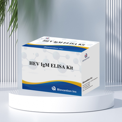 정확하고 민감한 엘리사 테스트 키트 HEV-IgM 진단 및 분석
