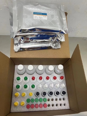 새로운 출입 IVD 반응기 HCV 진단 반응기 시험 인간 병원 클리닉 실험실