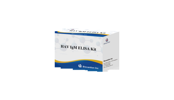 HAV IgM Elisa 테스트 간염 A 진단 키트