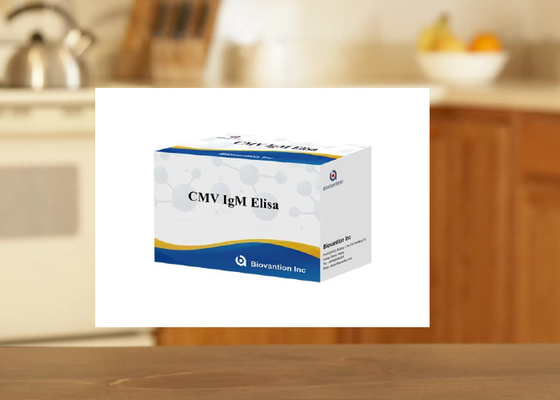 cMV IgM Elisa 검사 키트 효소 연결 면역 흡수 분석 키트 ELISA 검사 키트