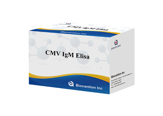 cMV IgM Elisa 검사 키트 효소 연결 면역 흡수 분석 키트 ELISA 검사 키트