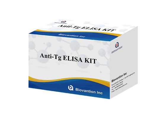 항 Tg ELISA 테스트 키트 티로글로불린 Ab in vitro 정량 결정