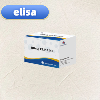 HBsAg ELISA 테스트 키트 반응기 효소 연결 면역 흡수 검사