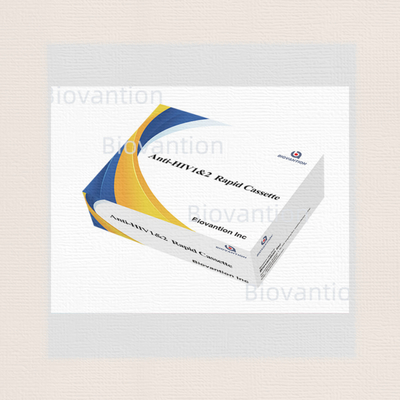 감수성 HIV 1/2 검출 읽기 시간 5분 25 테스트