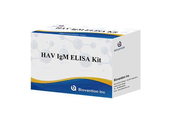 헤파티스 A 바이러스에 대한 항체 HAV IgM 인 비트로 효소 면역 검사 혈청 / 플라스마
