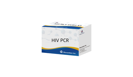실시간 RT-PCR 방법으로 인간 혈청 또는 플라스마에서 HIV-1 양적 RT-PCR 키트