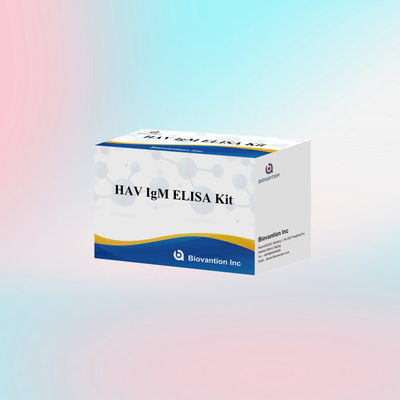HAV IgM ELISA Kit 고민성 A 바이러스 검출 임상 실험실용 신뢰성 높은 정확한 진단 검사