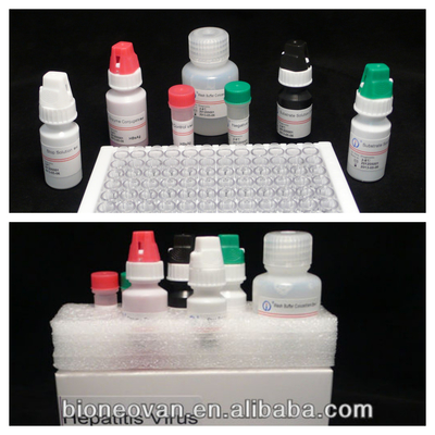 HBsAg ELISA 테스트 키트 HBsAg 바이러스의 질적 결정