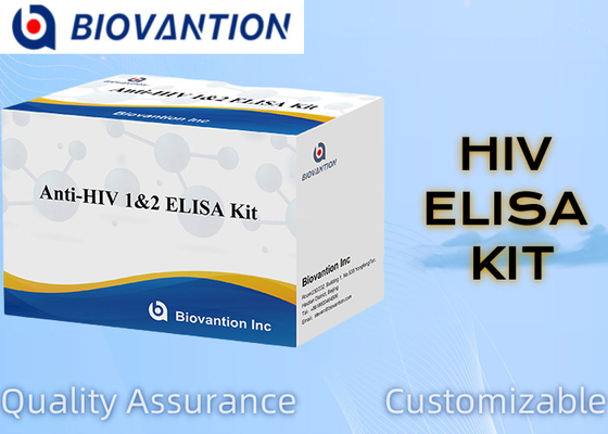 빠른 간편한 HIV ELISA 테스트 키트