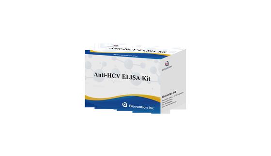 HCV 항체를 검출합니다.