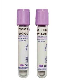 멸균 EDTA 혈액 채취 튜브 (2mL/3mL/5mL) 특수 검사