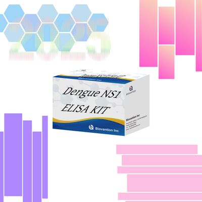 18개월 유효기간 고민성 및 96개의 테스트/ 병원 실험실 진단을 위한 IgM ELISA 테스트 키트